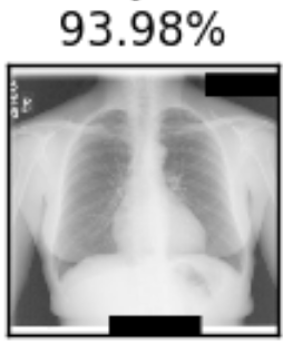 Chest X-ray with annotated score